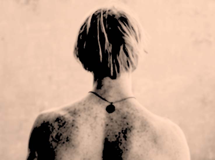 Patologie cutanee conosciute maggiormente diffuse